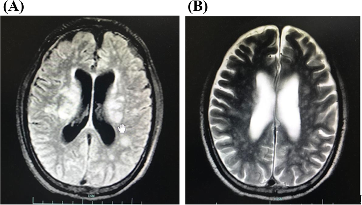 Fig. 2