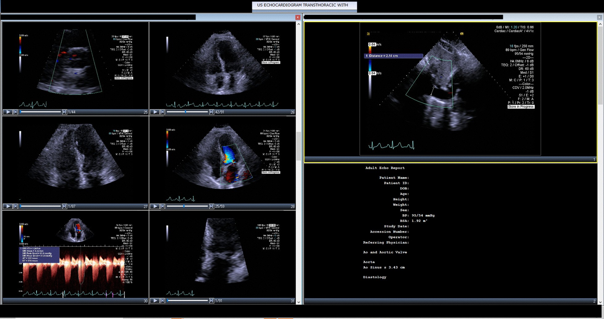 Fig. 3