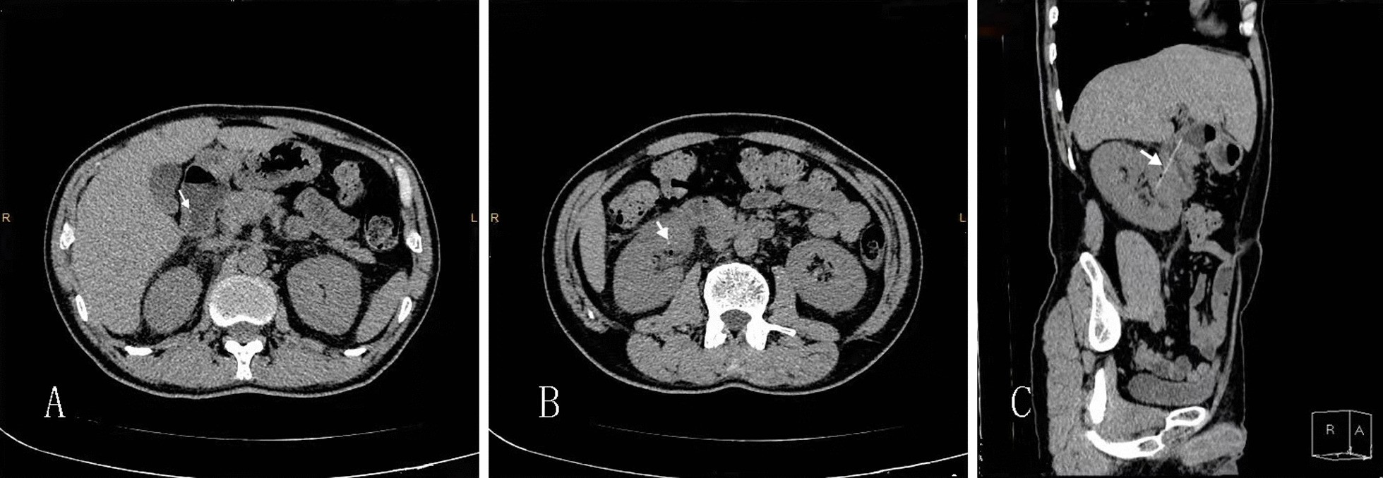 Fig. 2