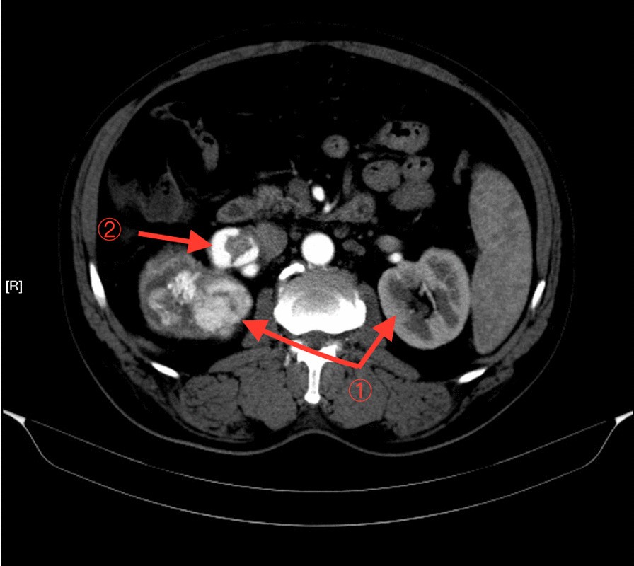 Fig. 2