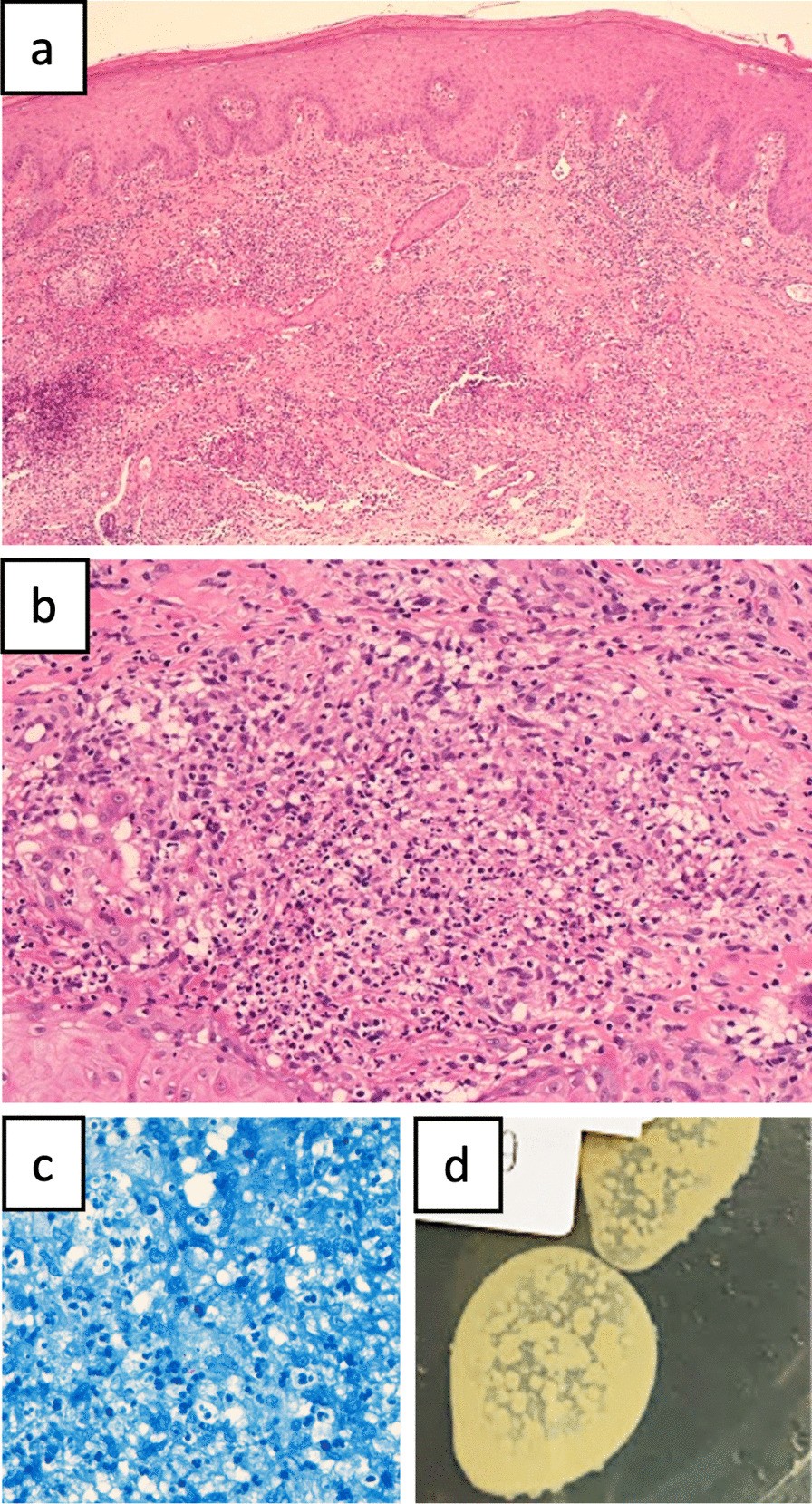 Fig. 2