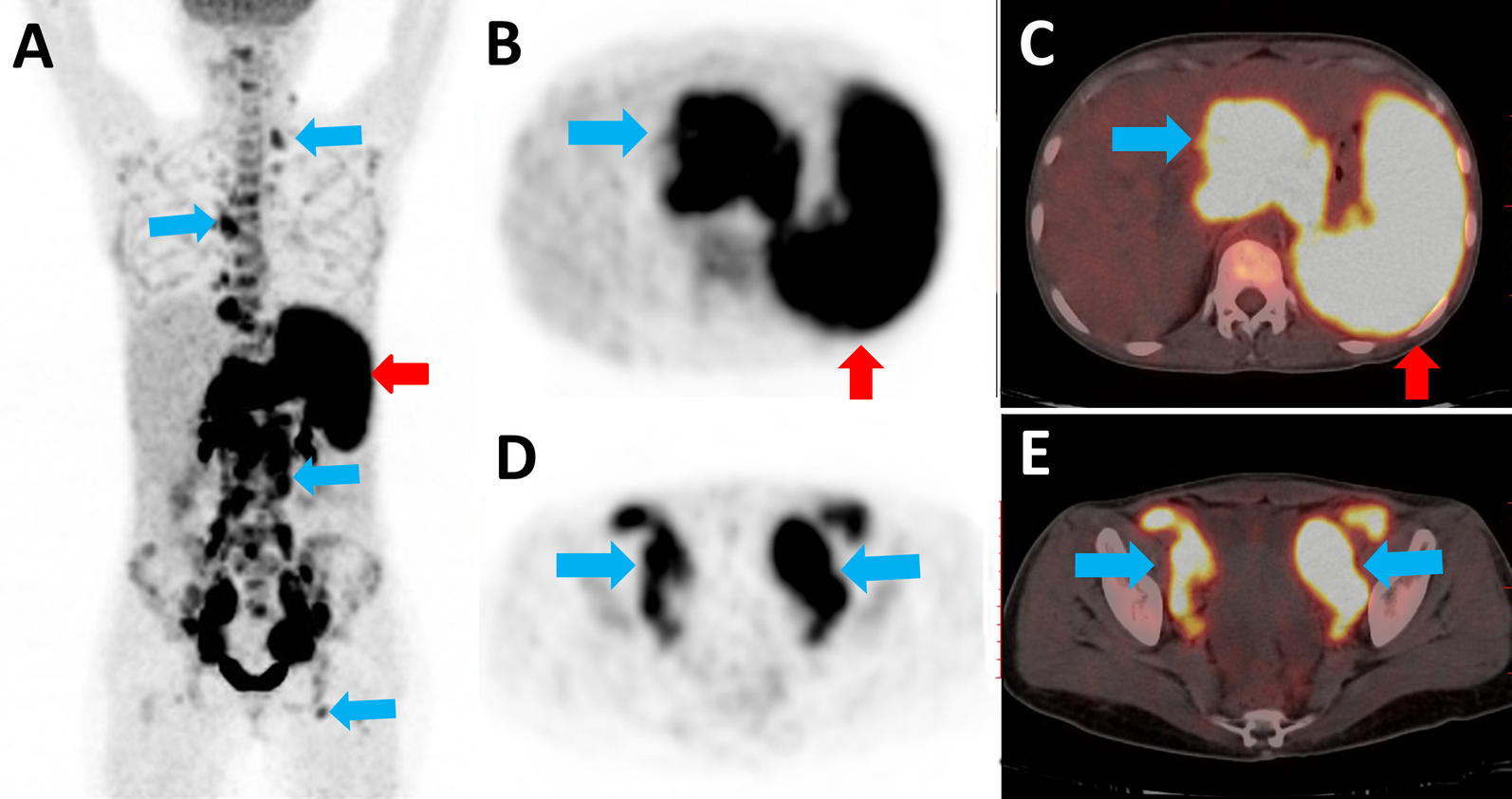 Fig. 1