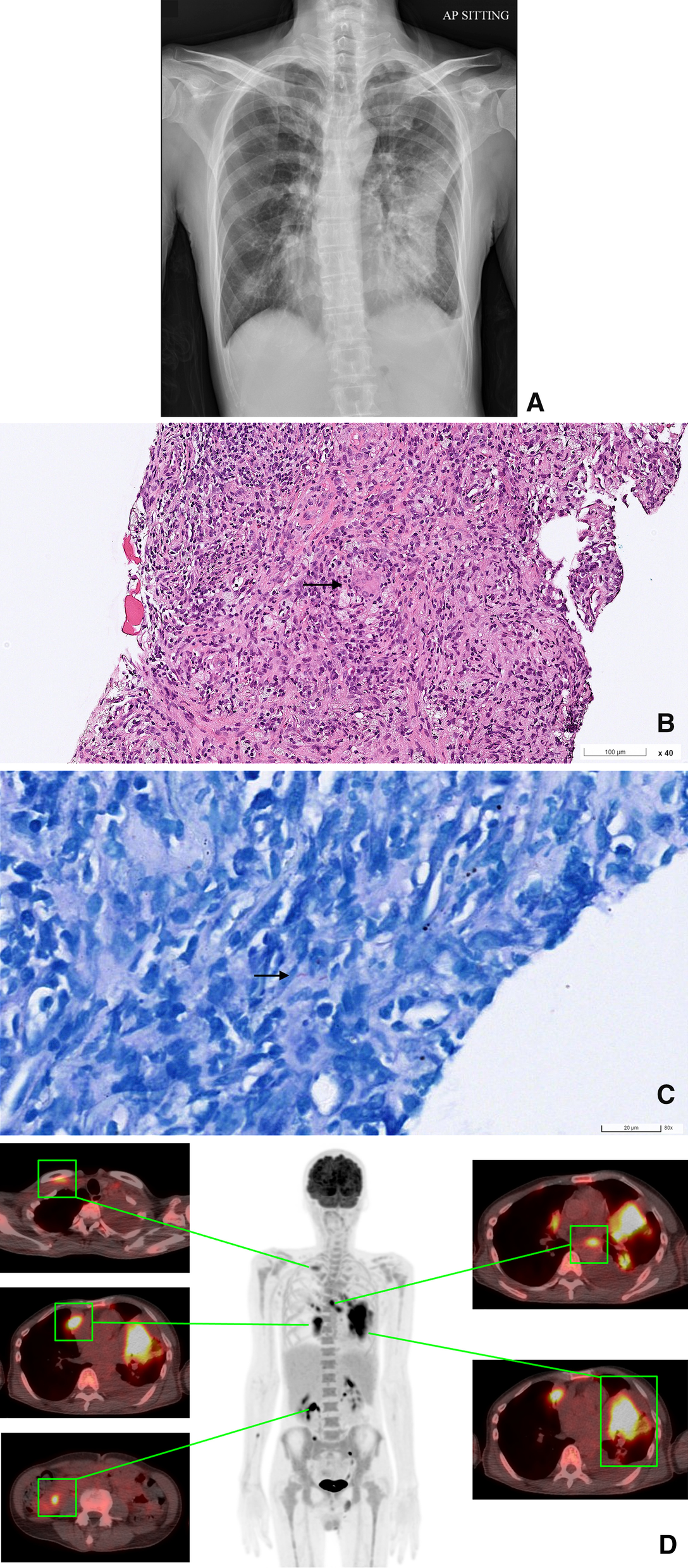 Fig. 1