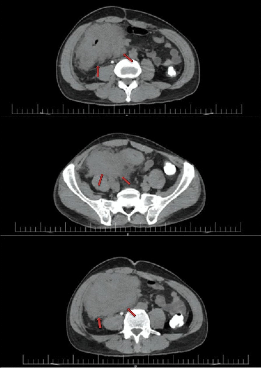 Fig. 2