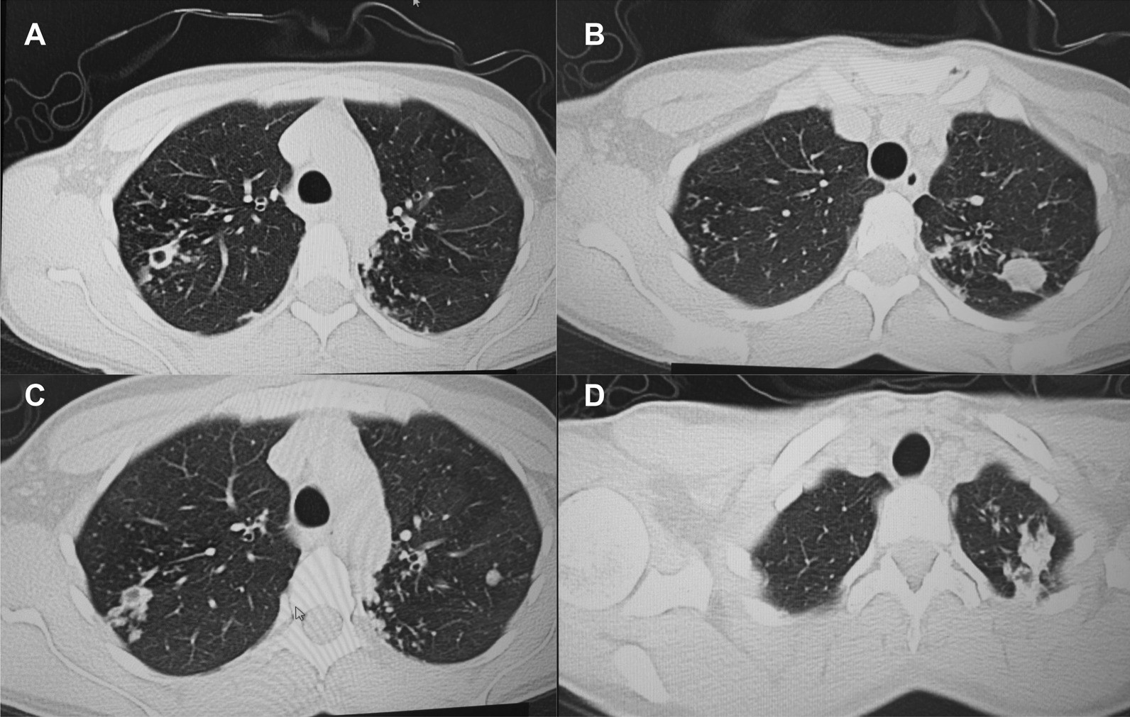 Fig. 3