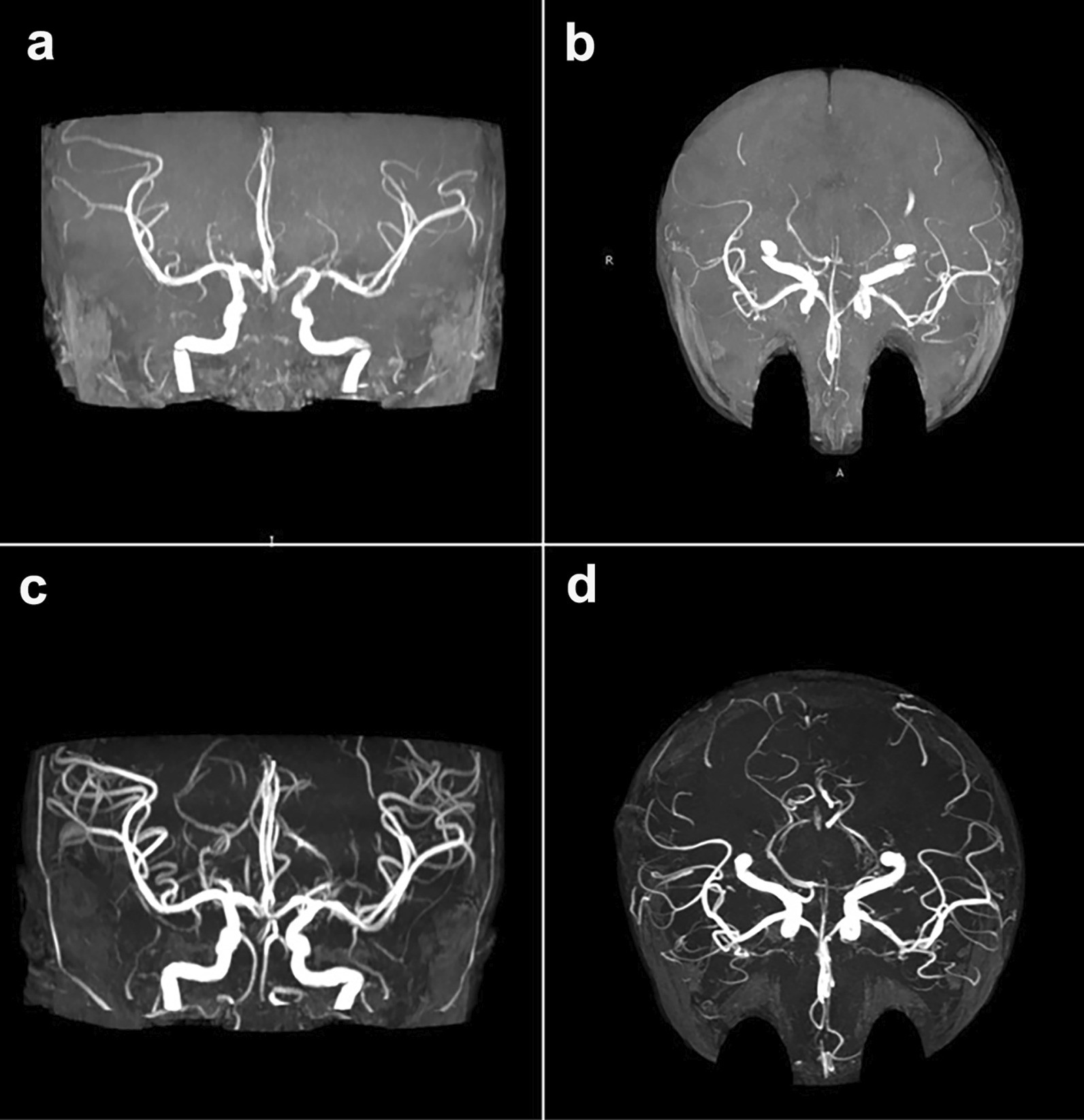 Fig. 4