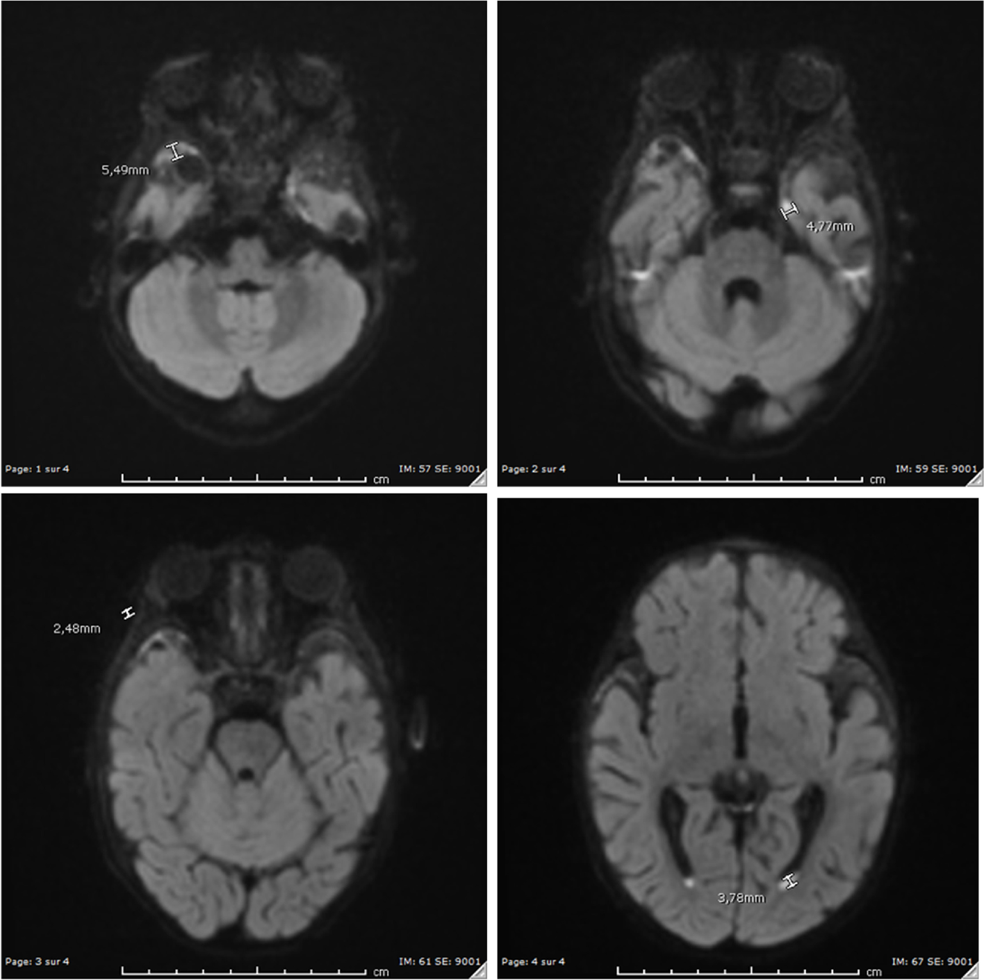 Fig. 2