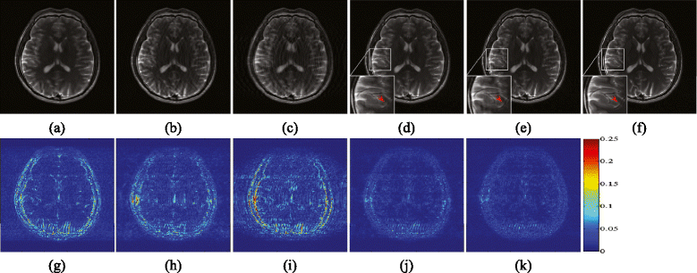 Fig. 5