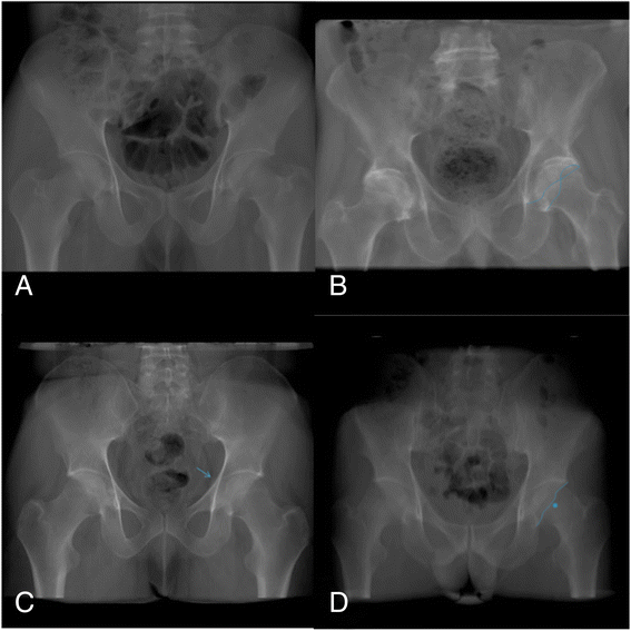 Fig. 2