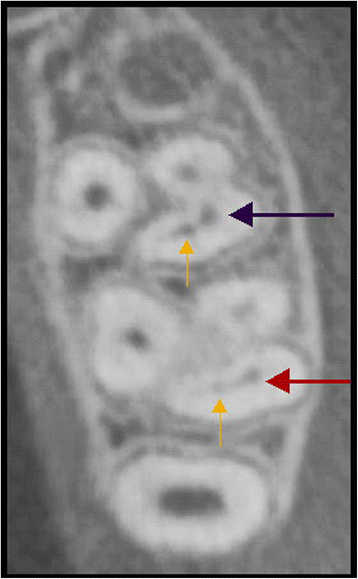 Fig. 3