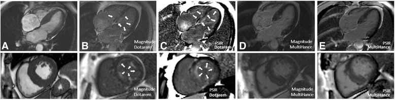 Fig. 4