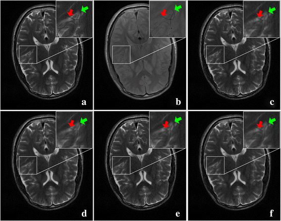 Fig. 11