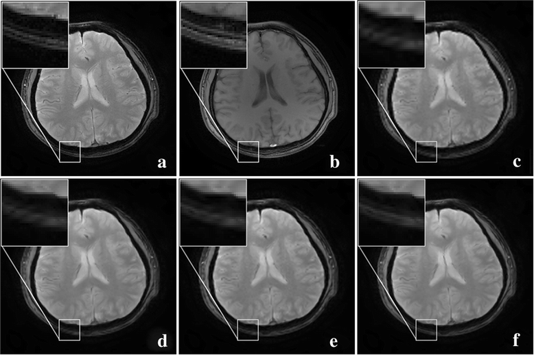 Fig. 9