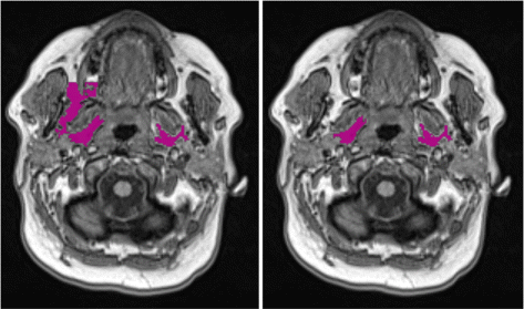 Fig. 8