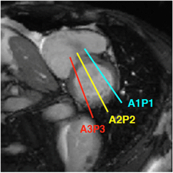 Fig. 12