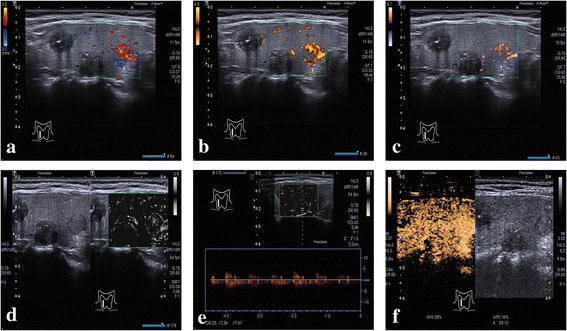 Fig. 4