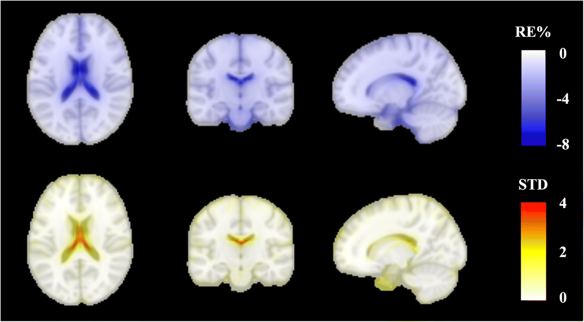 Fig. 11