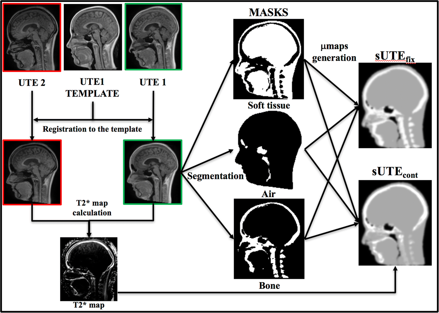 Accurate hybrid template–based and MR-based attenuation correction using  UTE images for simultaneous PET/MR brain imaging applications | BMC Medical  Imaging | Full Text