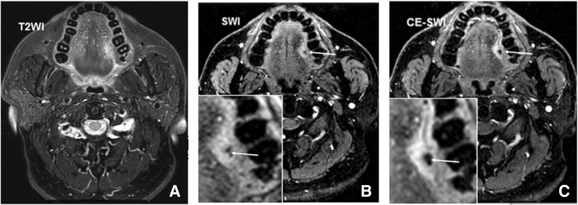 Fig. 6