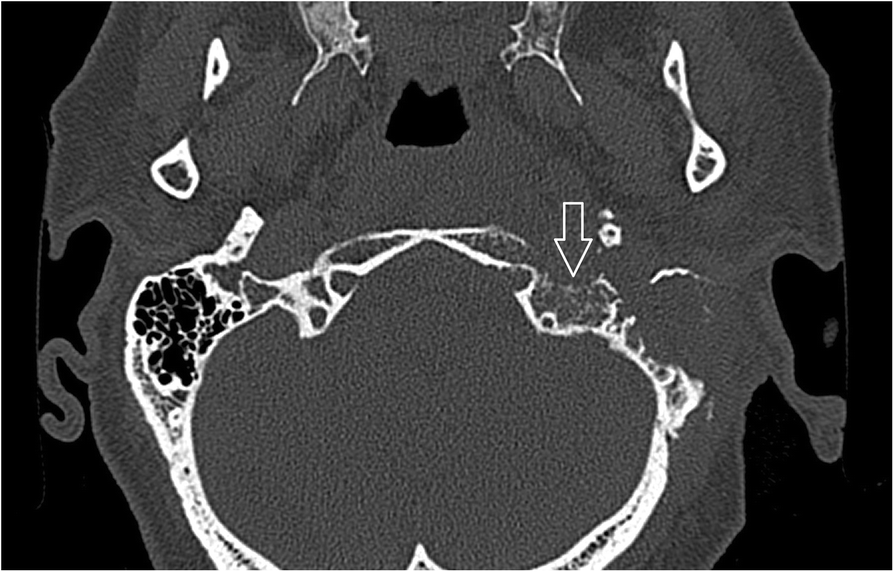 Fig. 11