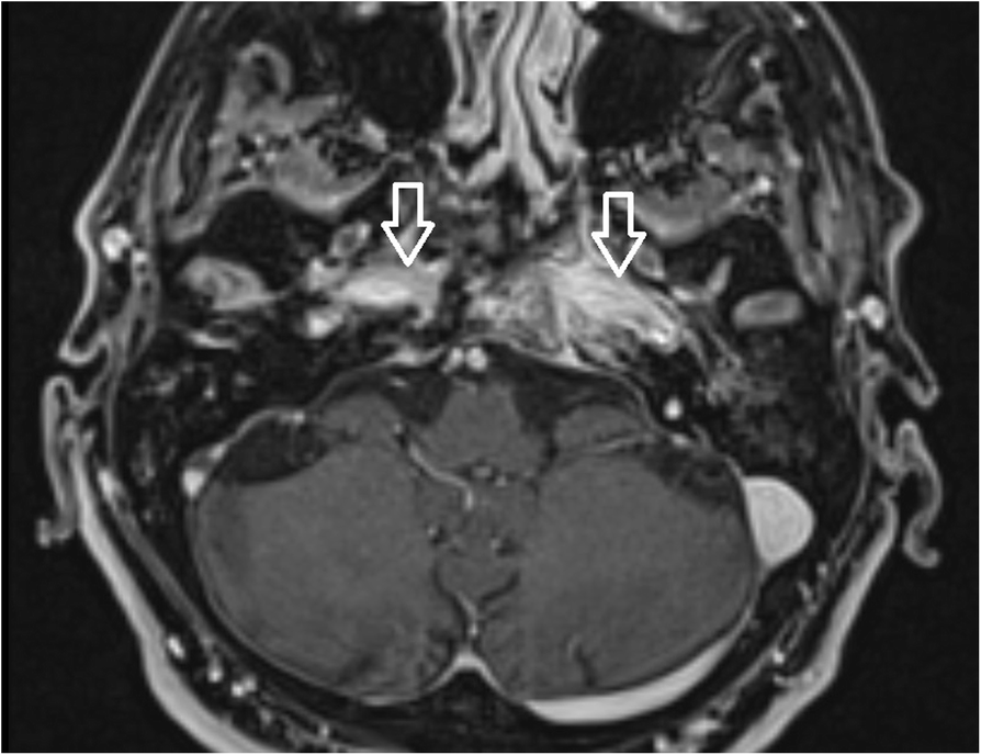 Fig. 8