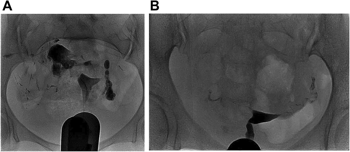 Fig. 2