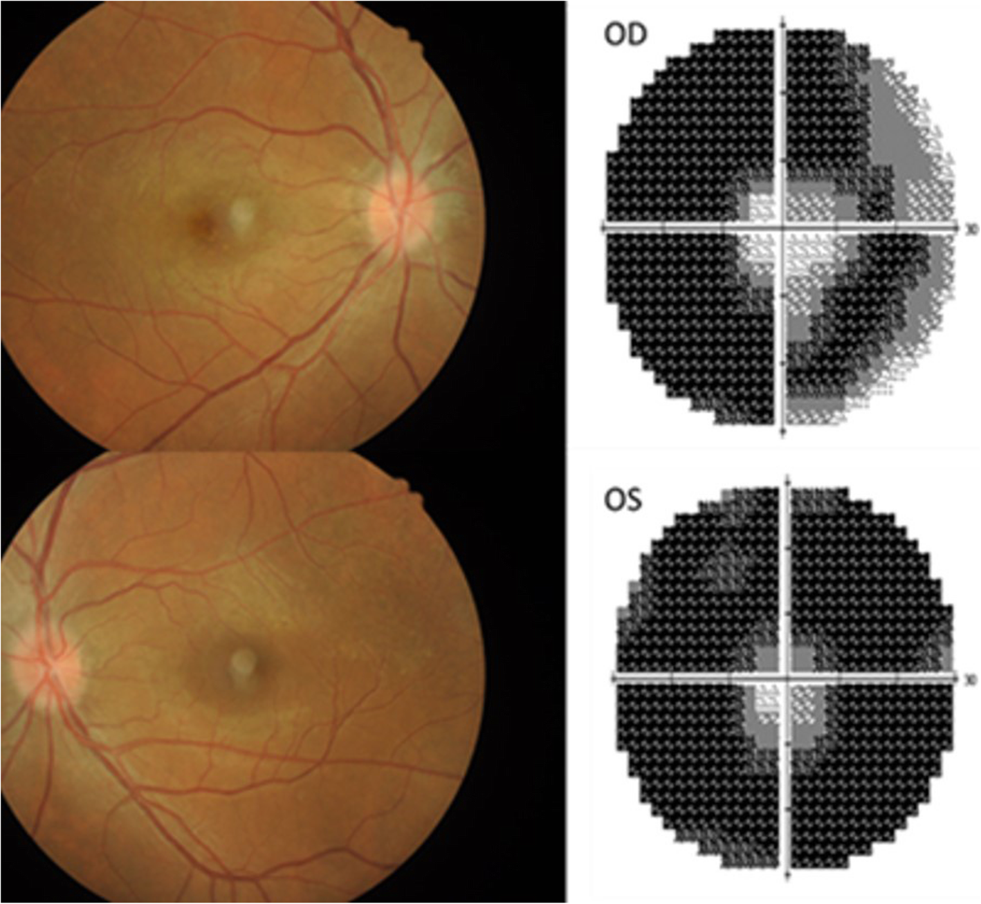 Fig. 2