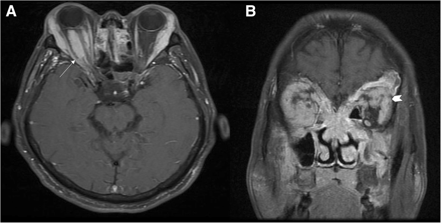 Fig. 5