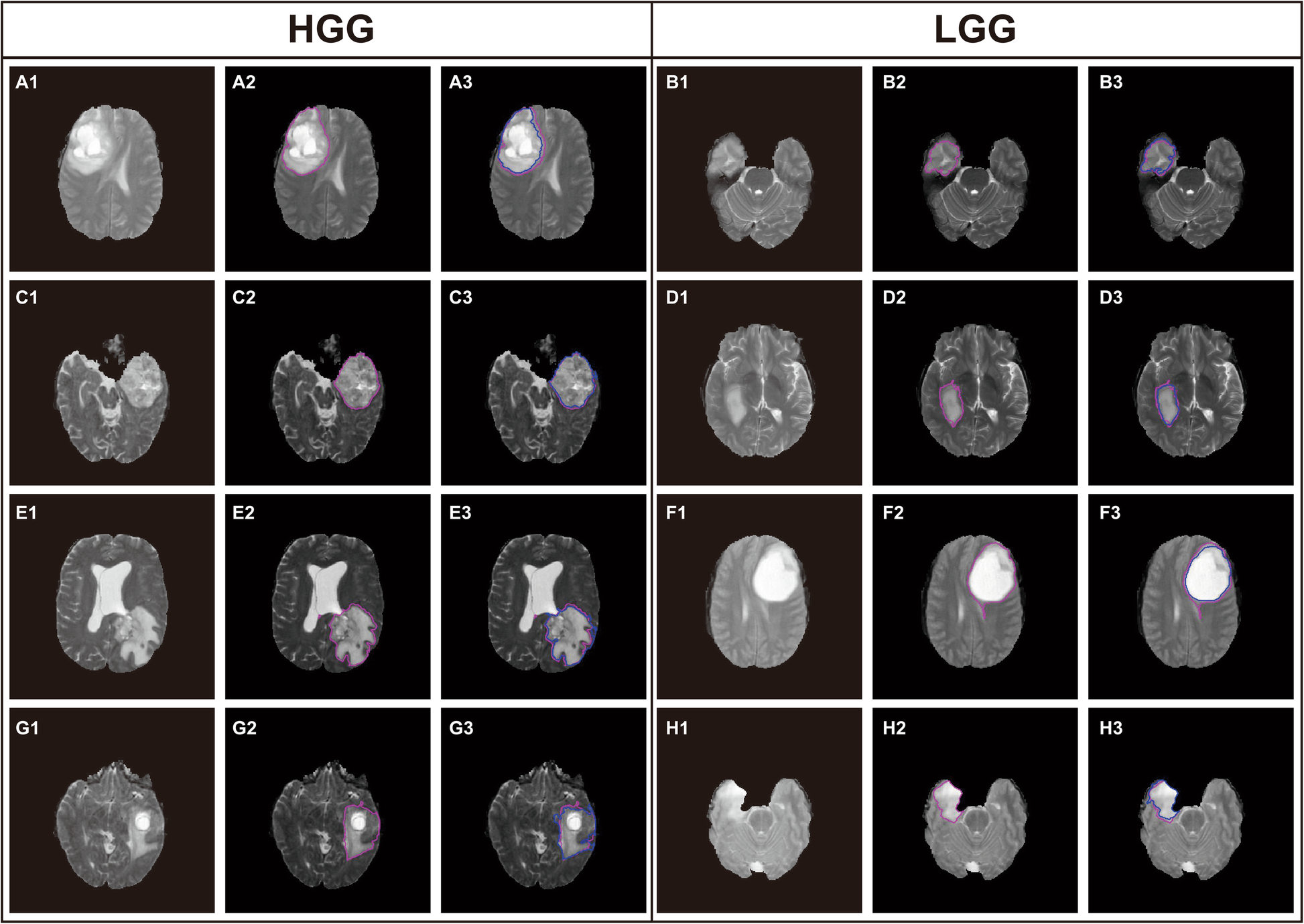 Fig. 10