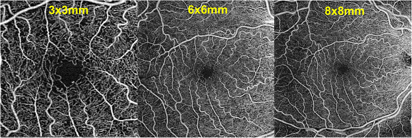 Fig. 2