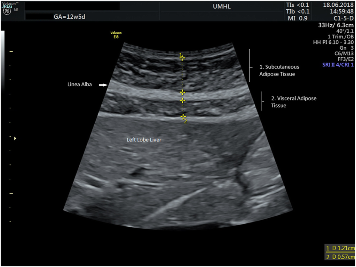 Fig. 1