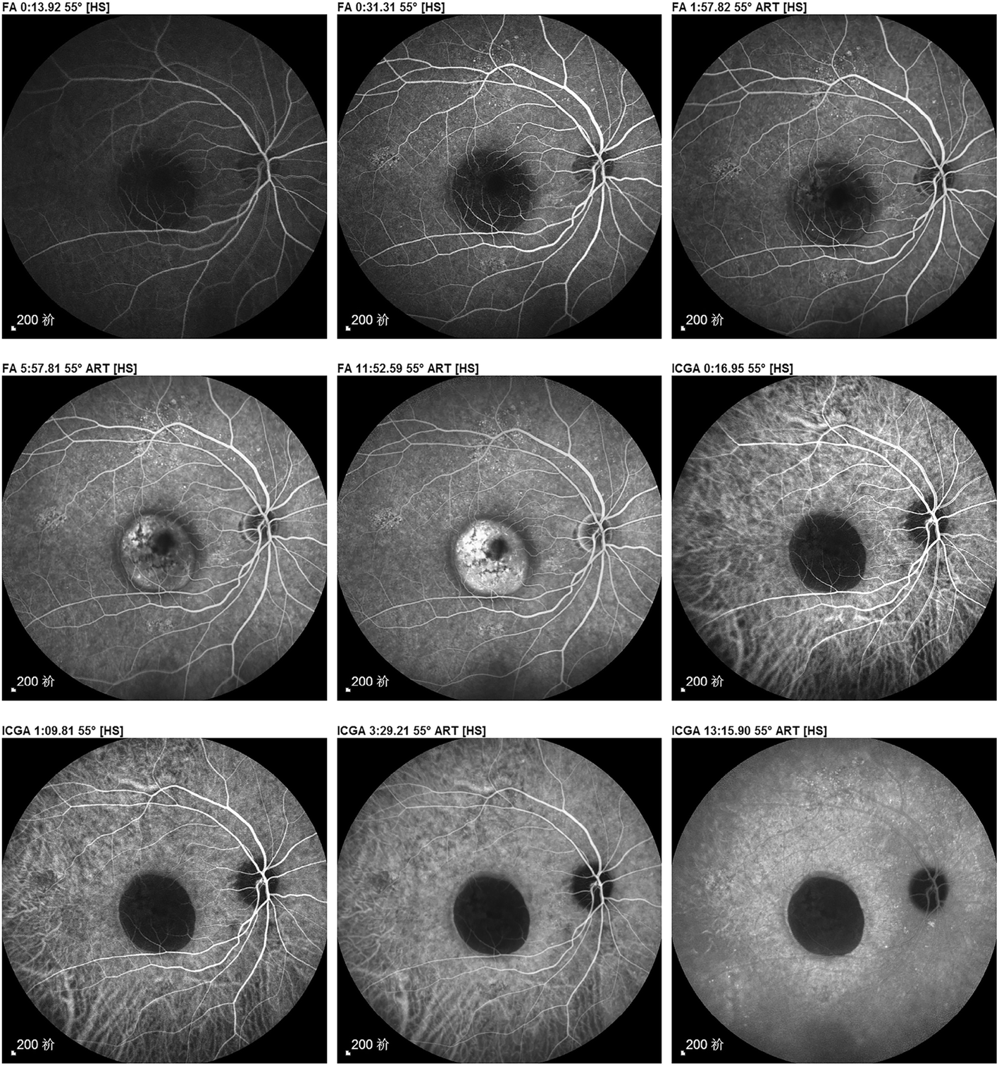 Fig. 3