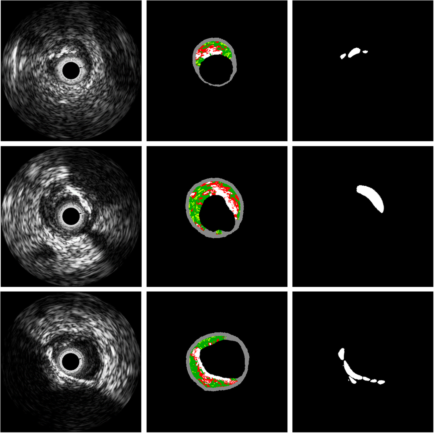 Fig. 6