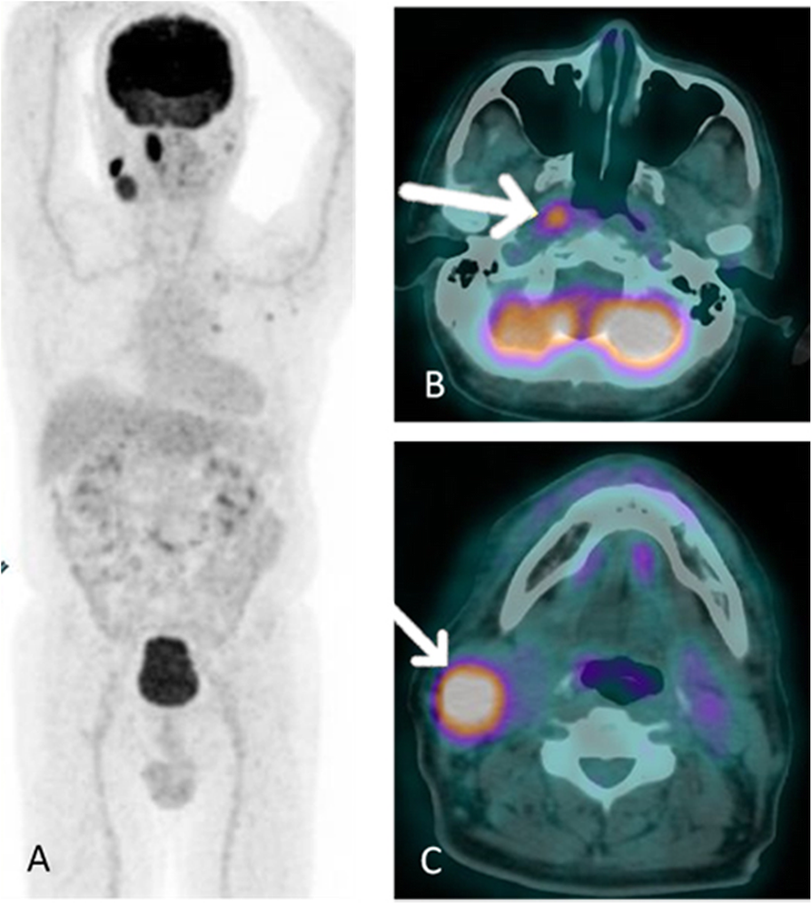 Fig. 1