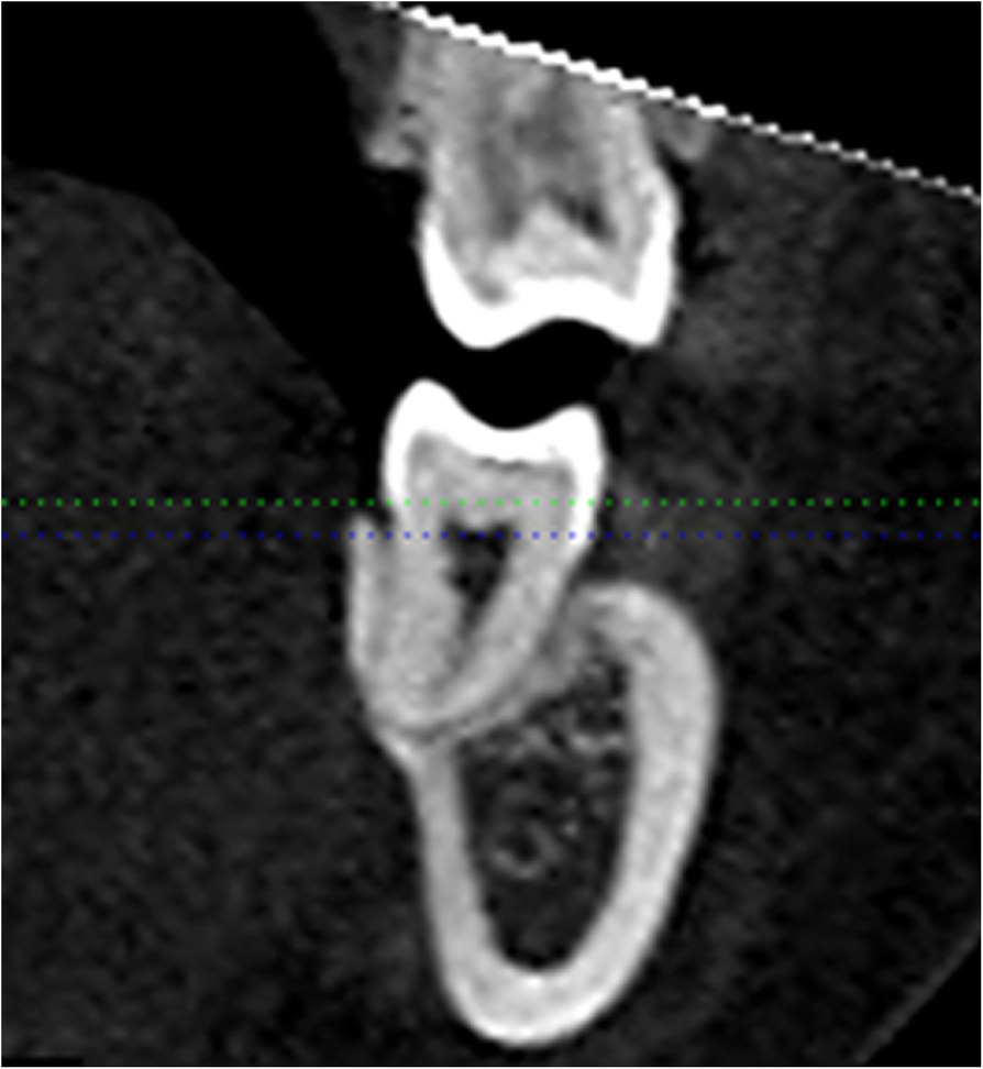 Fig. 5