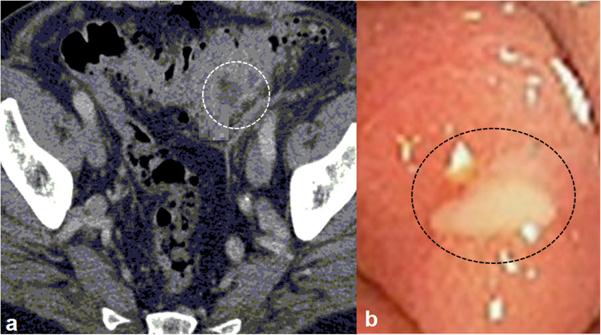 Fig. 2