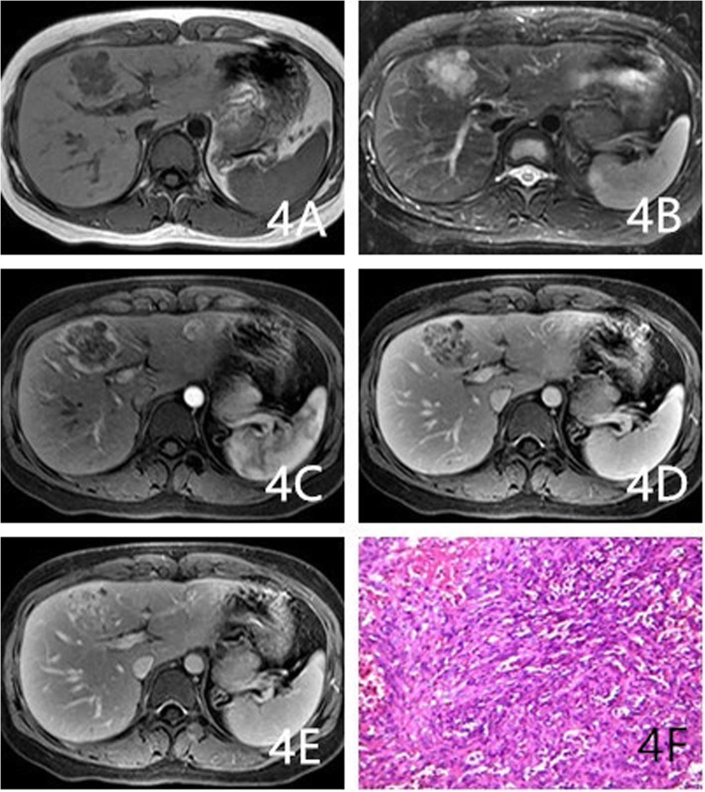 Fig. 4