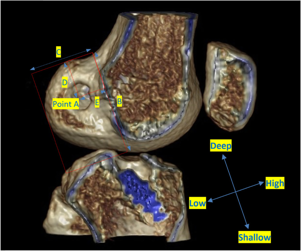 Fig. 1