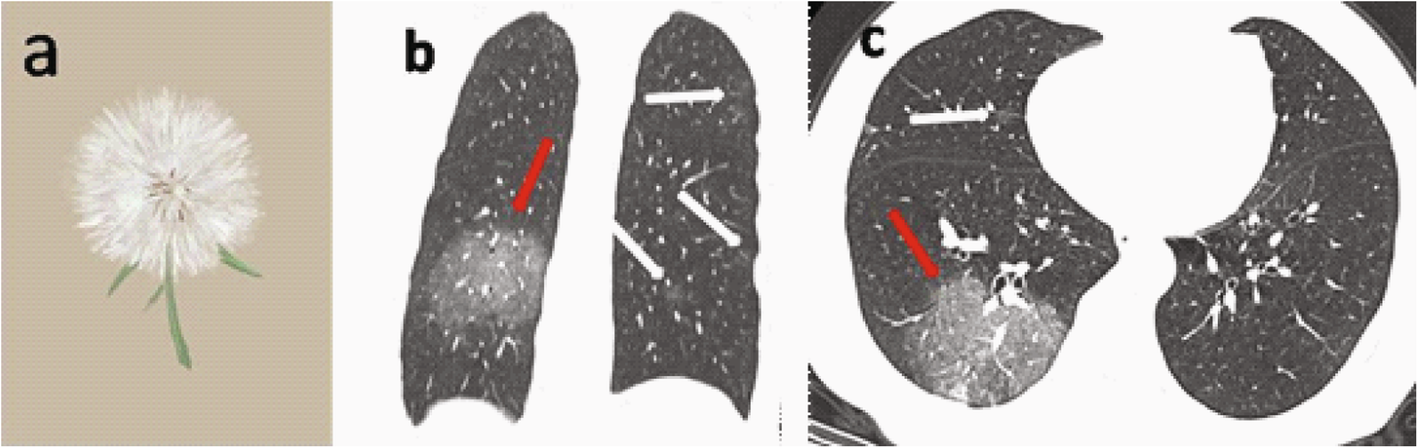 Fig. 2