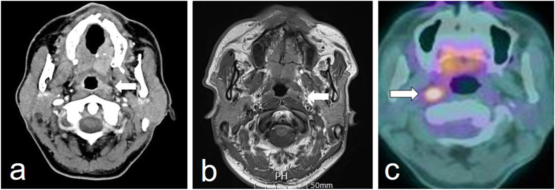 Fig. 2