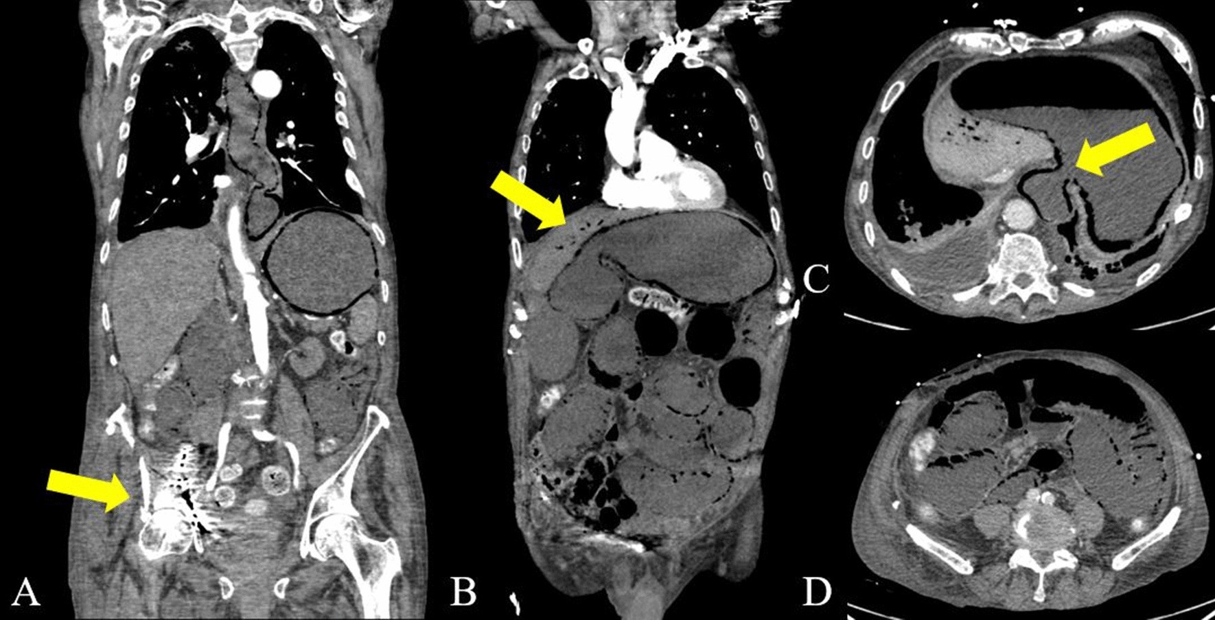 Fig. 6