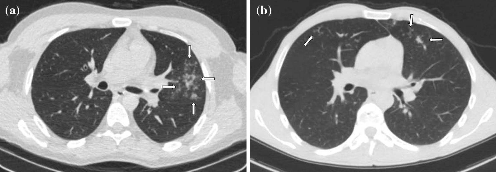 Fig. 5