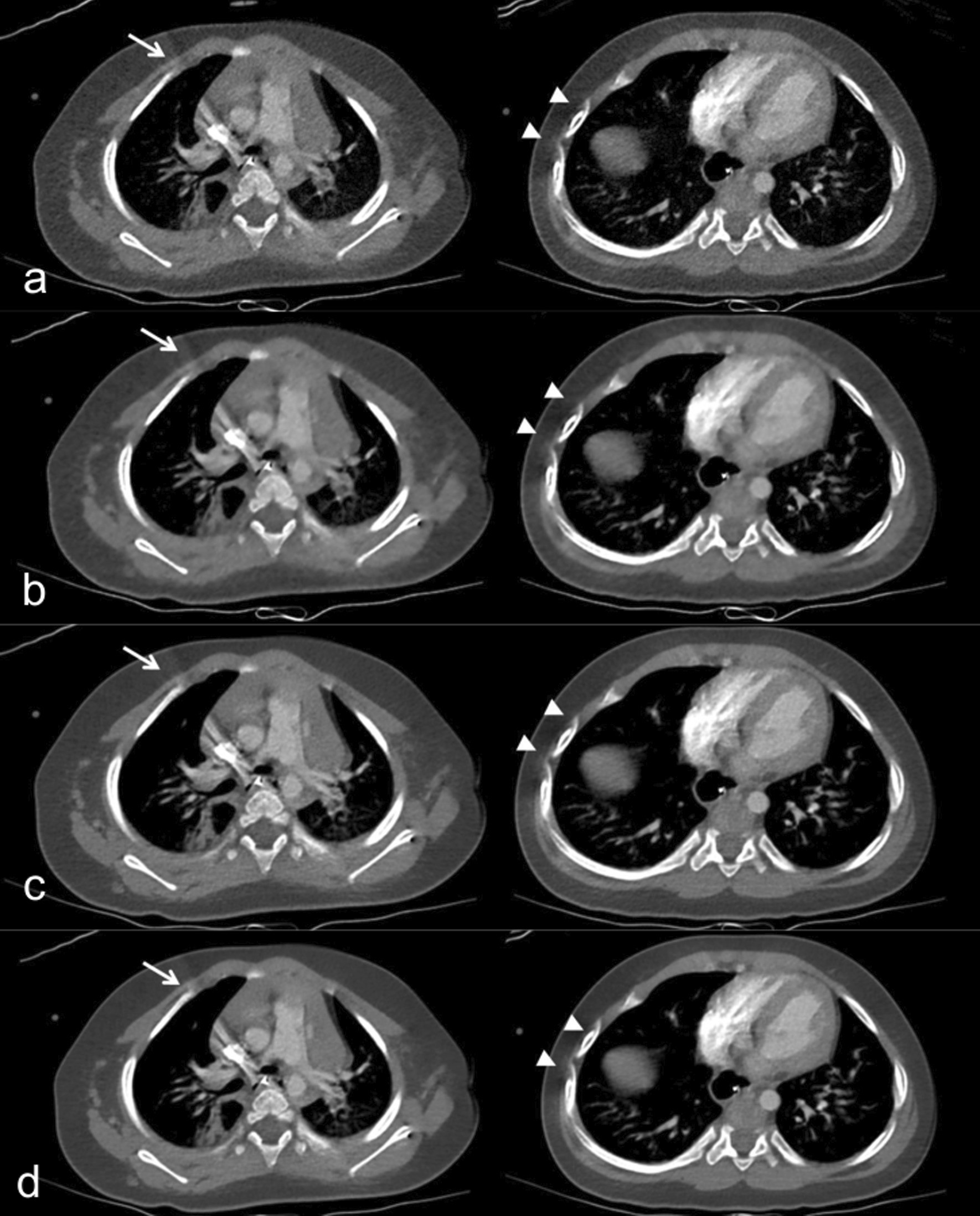 Fig. 5