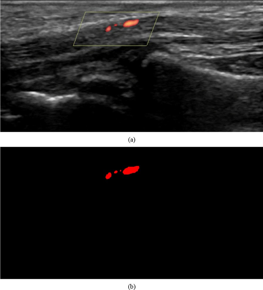 Fig. 4