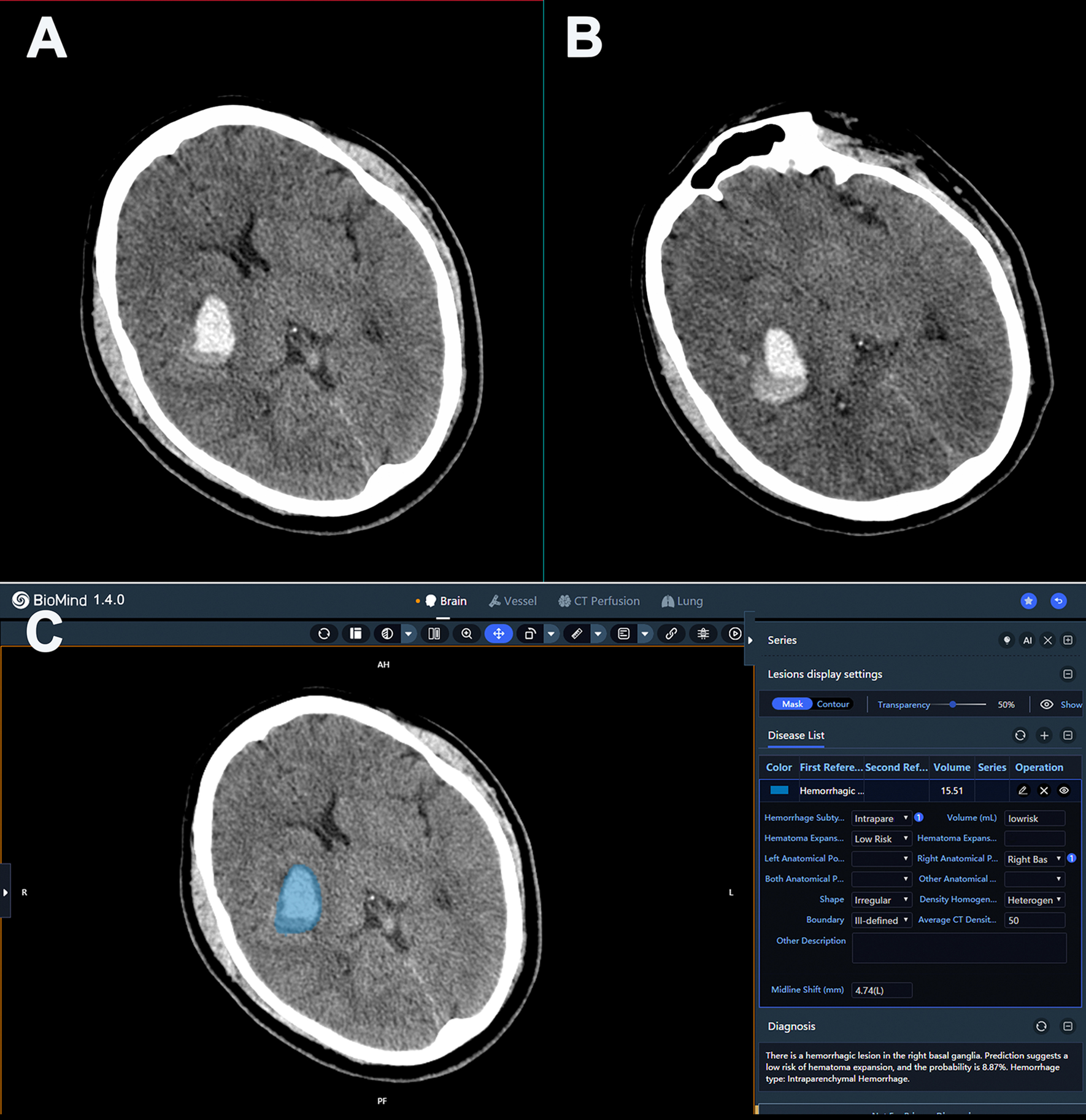 Fig. 4