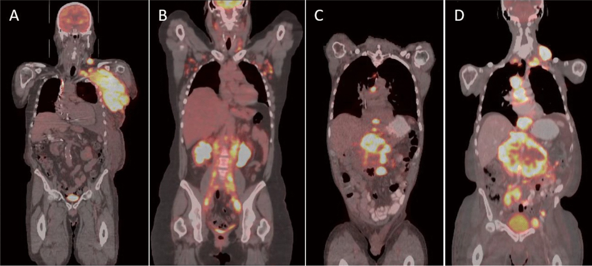 Fig. 11