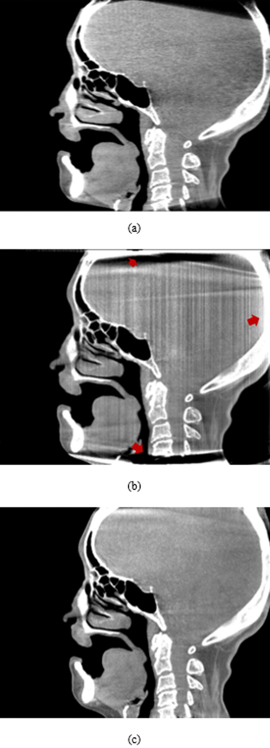 Fig. 10