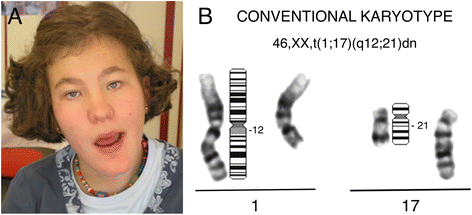 Fig. 1