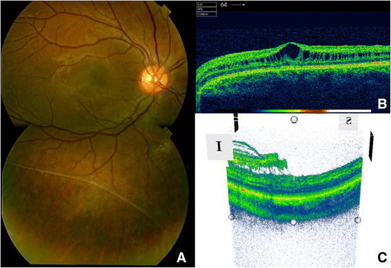 Fig. 1