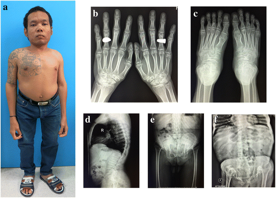 Fig. 3